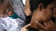 Alerta por cáncer de piel: 200 peruanos son derivados por sospecha de melanoma y Junín lidera casos