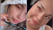 Lesly Águila aparece con aparente problema en los ojos: imágenes preocupan a los fans de Corazón Serrano