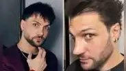 Nicola Porcella sorprende al mostrar su renovada nariz tras someterse a una nueva operación y genera reacciones