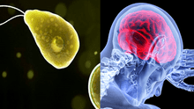 Ameba “come cerebros”: ¿qué es y cómo debemos cuidarnos de este parásito?