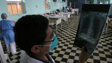 Personas entre 30 y 59 años lideran cifras de infectados por tuberculosis en Lambayeque