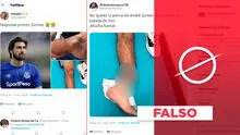 Fotos de un “tobillo destrozado” no corresponden a la fractura de André Gomes