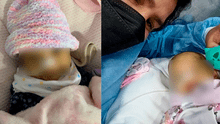 Mamá pide con urgencia traslado al extranjero de bebé de 5 meses con intestino ultracorto