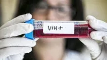La candidata a vacuna contra el VIH que es probada en Perú