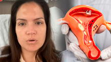 ¿Por qué Lorena Álvarez tuvo que someterse a una cirugía de extirpación de útero a sus 38 años?