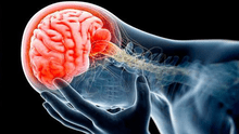 Ameba 'come cerebros': ¿Qué es, cuáles son los síntomas y cómo se contagia?