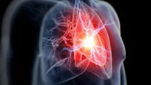 COVID-19: personas con enfermedades cardiovasculares tienen tres veces más riesgo de morir