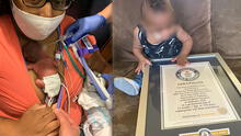 Récord Guinnes anuncia al bebé más prematuro del mundo en sobrevivir