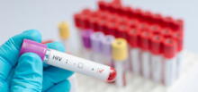Más de 50.000 personas vulnerables tuvieron acceso a pruebas de VIH en el norte