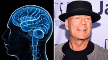 ¿Qué es la afasia?: conoce los efectos y el tratamiento de la enfermedad que sufre Bruce Willis