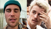 ¿Qué le pasó a Justin Bieber y en qué consiste el extraño síndrome de Ramsay Hunt que padece?