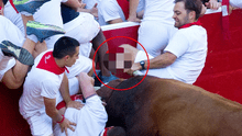 Imágenes espeluznantes muestran la pierna de un estadounidense corneado por un toro 