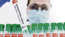 Esta semana publicarán plan de vacunación contra viruela del mono