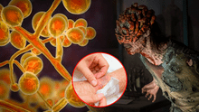 "The last of us": el hongo Cordyceps no es capaz de crear una epidemia, pero existe uno que sí