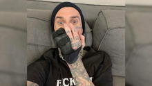 Blink-182: Travis Barker pasará por una cirugía tras lesionarse el dedo previo a gira internacional