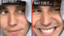Justin Bieber muestra cómo viene recuperando su sonrisa a meses de sufrir parálisis facial