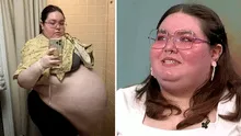 Mujer pensó que tenía obesidad, pero en realidad cargaba un quiste de casi 50 kilos