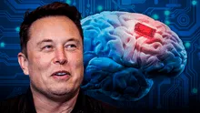 Neuralink de Elon Musk obtiene permiso para implantar chips en cerebros de humanos en EE. UU.