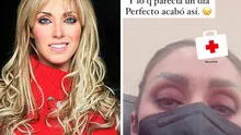 Anahí sufre accidente en ensayo de RBD y pierde la audición: "No oigo nada, estoy en shock"