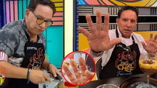 Así quedaron las manos de Ricardo Rondón tras quemaduras en "El gran chef": "Soy duro de matar"