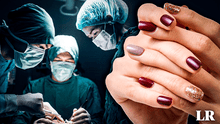 ➤Las razones por las que no debes llevar uñas pintadas a sala de operaciones