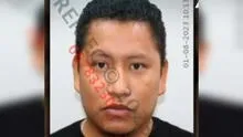La Victoria: hombre que atacó a su pareja y conserje de hotel está libre pese a antecedentes policiales