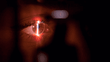 Inteligencia artificial detecta signos del párkinson en los ojos 7 años antes de los primeros síntomas