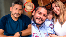 Guillermo Suárez: ¿qué se sabe de la salud del fotógrafo venezolano atropellado en Caracas?