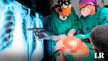 Equipo de más de 20 médicos extirpa un tumor de 4,2 kilos en operación de 11 horas en Chile