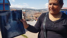 Madre denuncia bullying después de que su hija sea hospitalizada tras ingerir grapa en colegio de Cusco