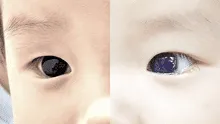 Color de ojos de bebé cambia tras recibir presunto fármaco contra la COVID-19