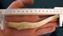 ¿Por qué los hombres perdieron el hueso del pene cuando evolucionaron?