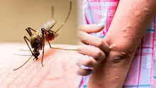 ¿Por qué hay tantos mosquitos en Arequipa y qué hacer para protegernos de ellos?