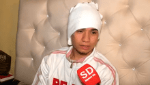 Chancay: joven le arranca la oreja a cantante de cumbia tras una pelea