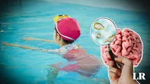 Niña de 10 años muere tras contraer una ameba comecerebros al nadar en una piscina de Colombia