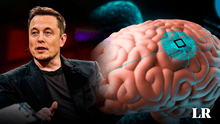 Musk anuncia primer implante cerebral de Neurolink en humanos: promete recuperar movimiento y visión