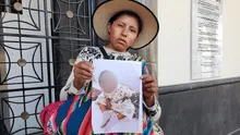 Madre pide apoyo para su hija internada tras accidente mientras jugaba, en Arequipa