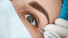 ¿Qué es la queratopigmentación? La peligrosa operación cosmética podría dejarte sin visión