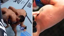 Luchador mordió a su rival, fue expulsado y el dueño de UFC regaló 50.000 dólares al afectado