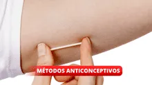 Todo sobre el implante subdérmico: ¿cómo se utiliza este método anticonceptivo?