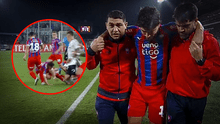 La terrible lesión que sufrió el jugador de Cerro Porteño que lo descarta ante Alianza
