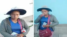 Madre necesita 70.000 soles para reconstruir rostro de su hijo, quien sufrió accidente en Arequipa