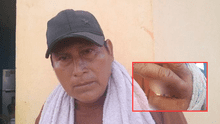 Iquitos: hombre ataca con cuchillo a vecino porque se negó a darle S/2 para comprar trago