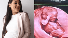 Así luce la prominente pancita de embarazo de Samahara Lobatón a sus 4 meses