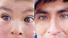 Peruano muestra los ojos ‘hazel’ de su familia y usuarios dicen: “Yo heredé miopía y astigmatismo”
