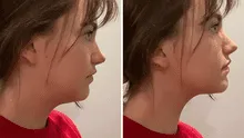 ¿Qué es el 'mewing'? El ejercicio viral de TikTok que promete transformar el rostro: elimina la papada y afina la mandíbula