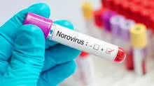 Cuáles son los síntomas del Norovirus y cómo prevenir su contagio en Estados Unidos