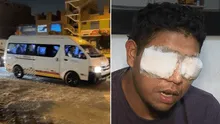 Chofer de 'La Colonial' podría quedar ciego tras ser baleado por extorsionadores que exigían el pago de cinco soles diarios