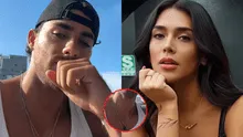 Austin Palao sorprende con supuesto chupetón tras ampay con Vania Bludau en boda de Alejandra Baigorria