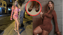 Delany López se ríe cuando le consultan por los pies de Xiomy Kanashiro: “Estaban raros”